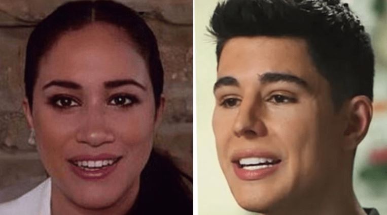 Megan Markle and Omid Scobie, did they go under the knife with same surgeon