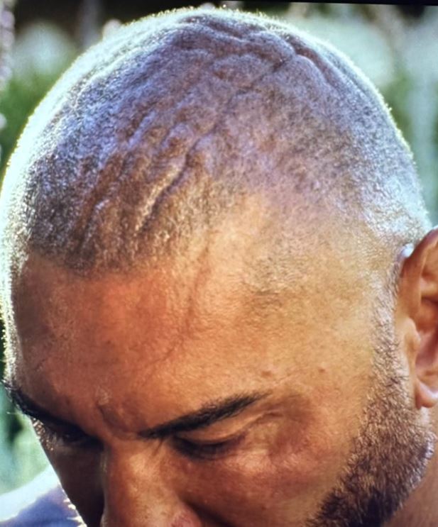 Dave Bautista scalp wrinkles