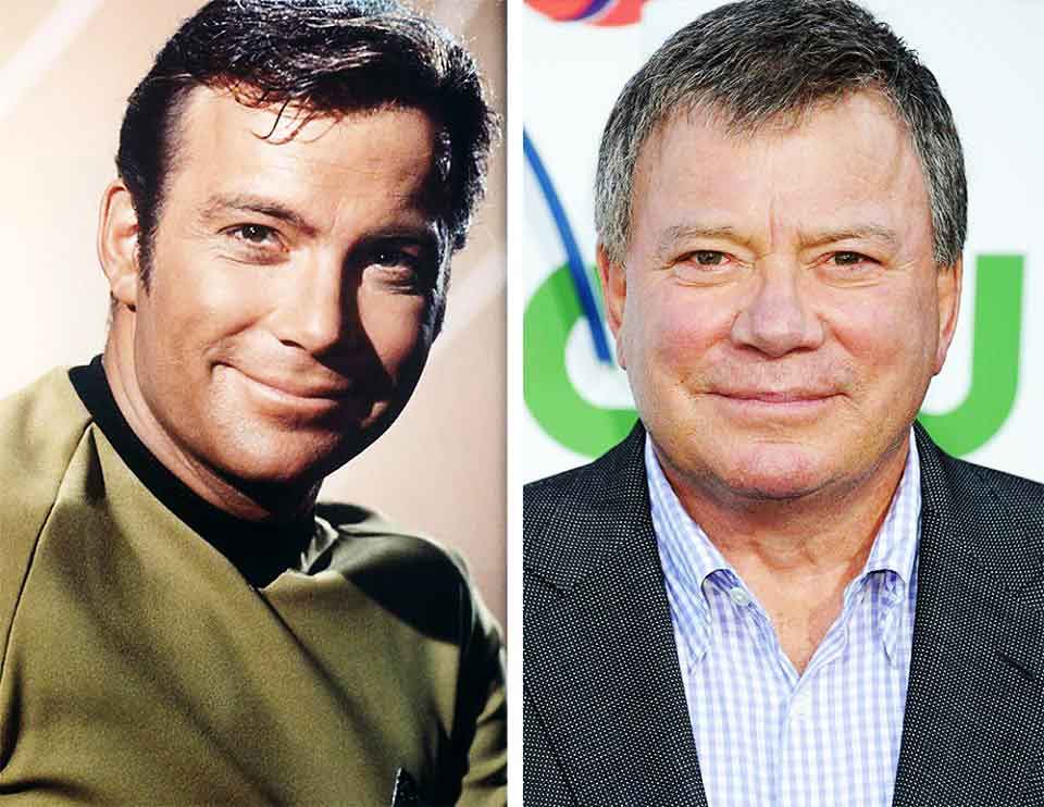 William Shatner before and after