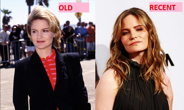 Jennifer Jason Leigh before and after plastic surgery
