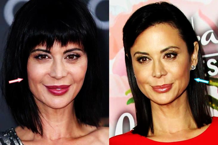 Catherine Bell used Botox injection to make her skin smooth and wrinkle-free