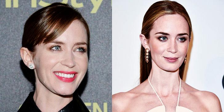 Emily Blunt before and after alleged surgery