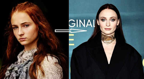 Sophie Turner's before and after photo compared