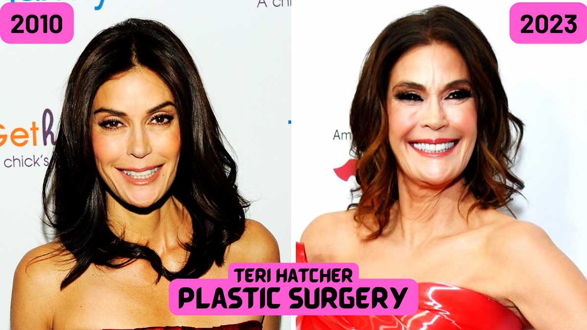 housewives teri hatcher breast implant