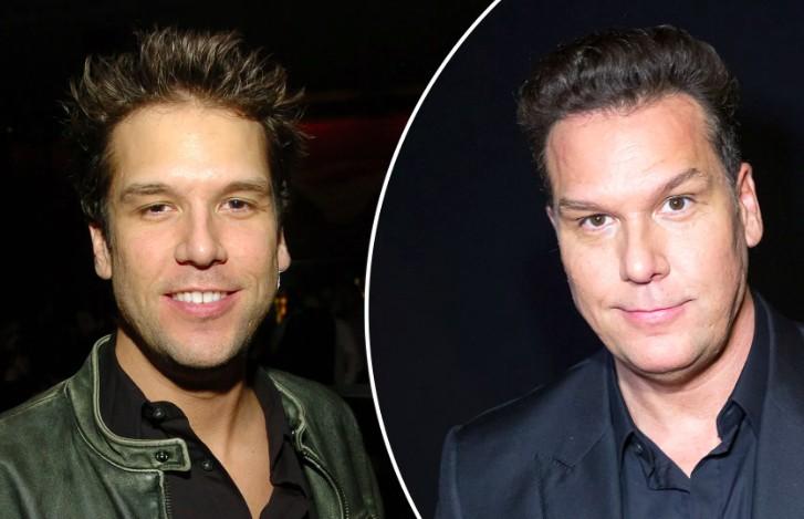 Dane Cook before and after photo