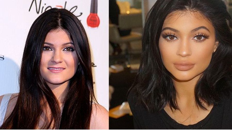 Kylie's face has transformed over years
