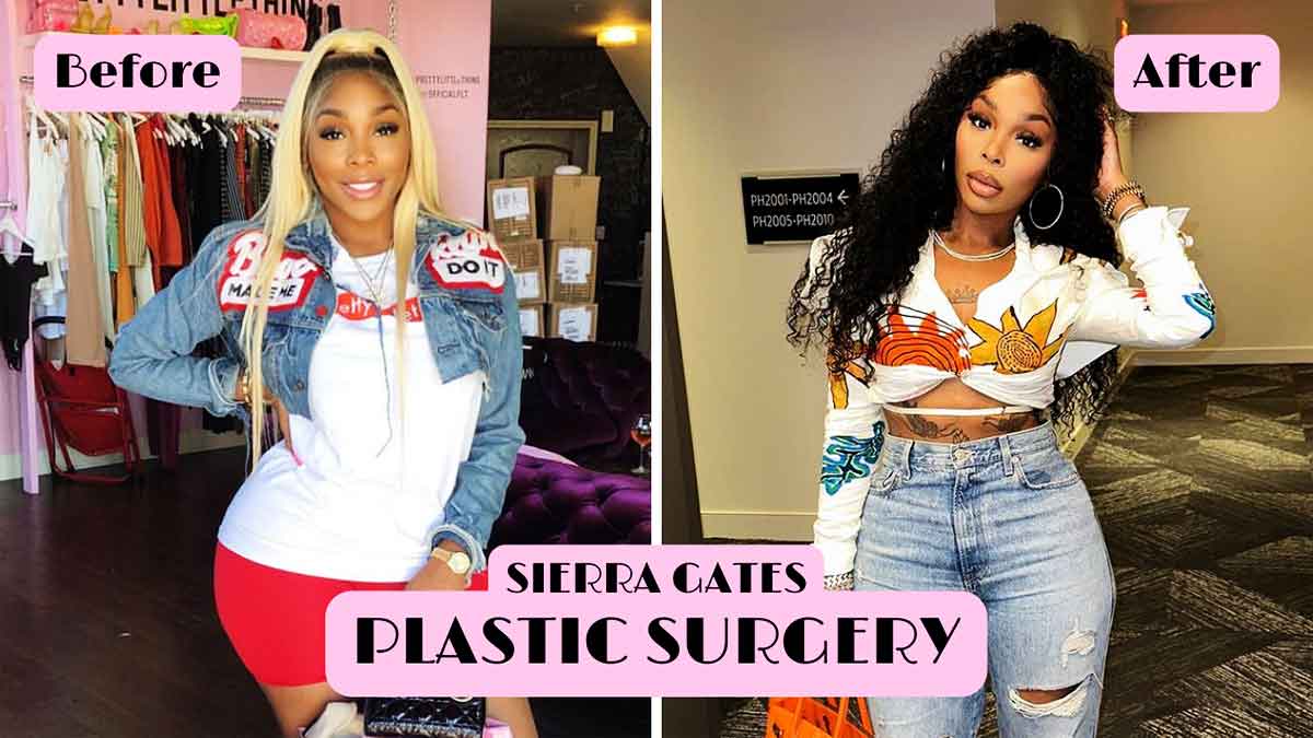 Love & Hip Hop star Sierra Gates' plastic surgery allegations - true?