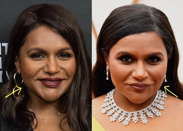 Mindy Kaling before and after having a Botox
