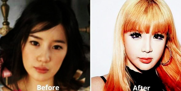Park Bom before ad after alleged plastic surgery