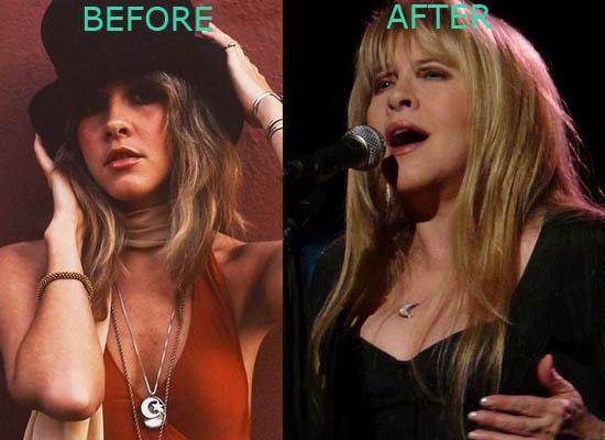 Stevie Nicks before and after the boobs job